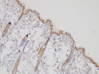 SERPINB2 Polyclonal Antibody