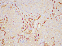 ANGPT2 Polyclonal Antibody