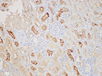 ANGPT2 Polyclonal Antibody