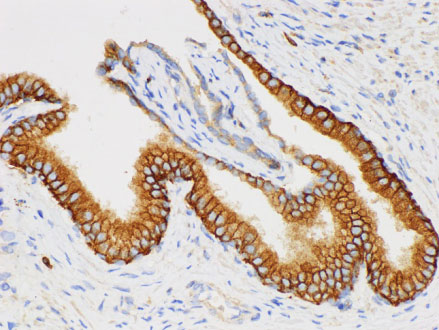 CD38 Polyclonal Antibody