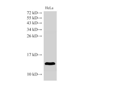 B2M Polyclonal Antibody
