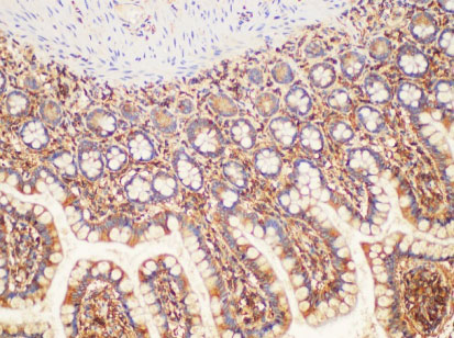 B2M Polyclonal Antibody