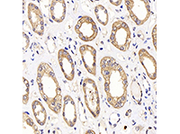 LDHA Polyclonal Antibody