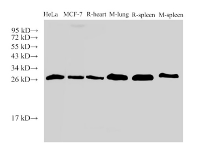 Galectin 3 Polyclonal Antibody