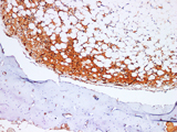 TIMP1 Polyclonal Antibody