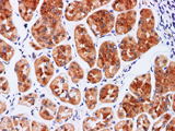 TIMP1 Polyclonal Antibody