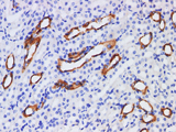 CK-7 Polyclonal Antibody