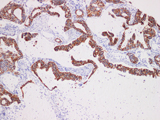 CK-7 Polyclonal Antibody