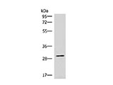 CDK4 Polyclonal Antibody