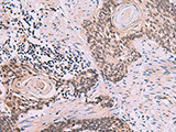CDK4 Polyclonal Antibody